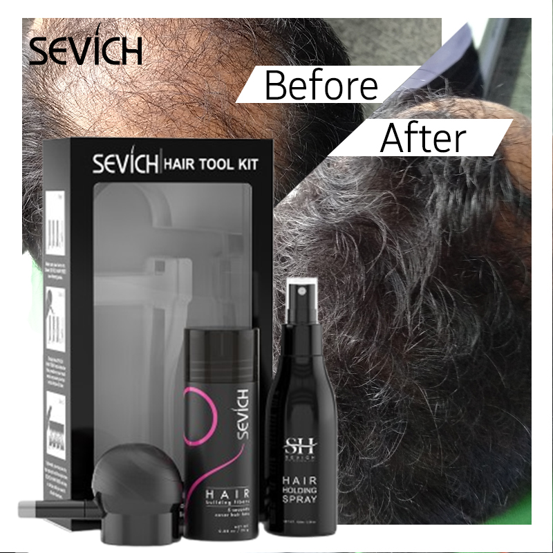 Black Hair Fibers Set Hair Gro - Keratin Treatment Set 评论和价格